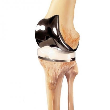 Legion Total Knee System with Verilast Technology, manufactured by Smith & Nephew Inc.